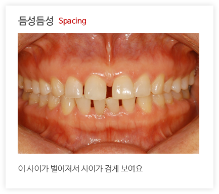 듬성듬성 Spacing