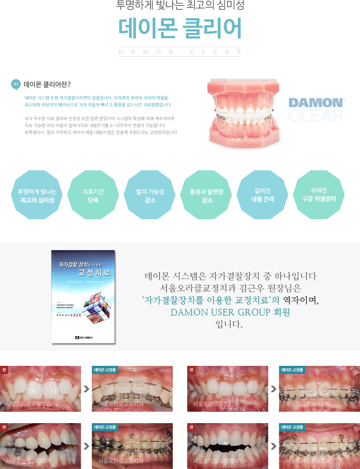 데이몬 클리어