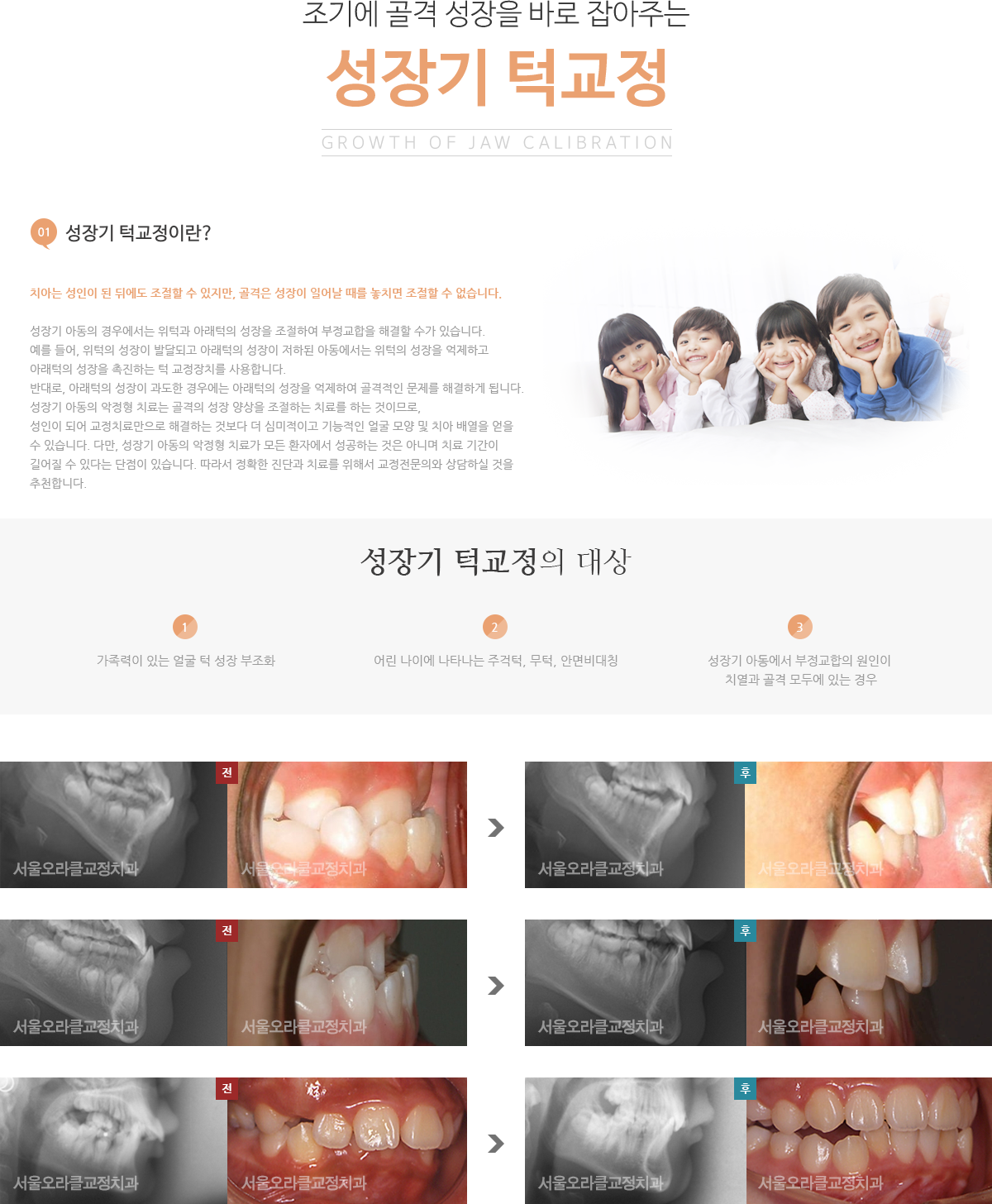 성장기 턱교정